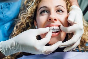 Dentist putting in Invisalign for patient