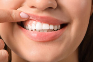 Young,Woman,With,Healthy,Gums,